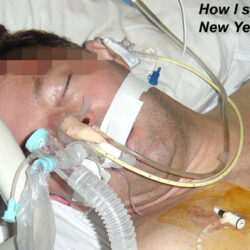 Dellis lies in a Coma for 3 weeks.